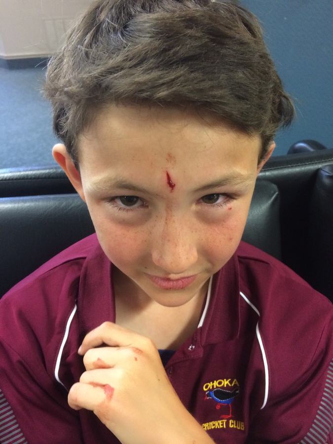 Boy in cricket kit with a grazed forehead