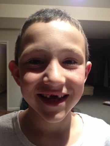 Close-up of a grinning boy with a missing front tooth