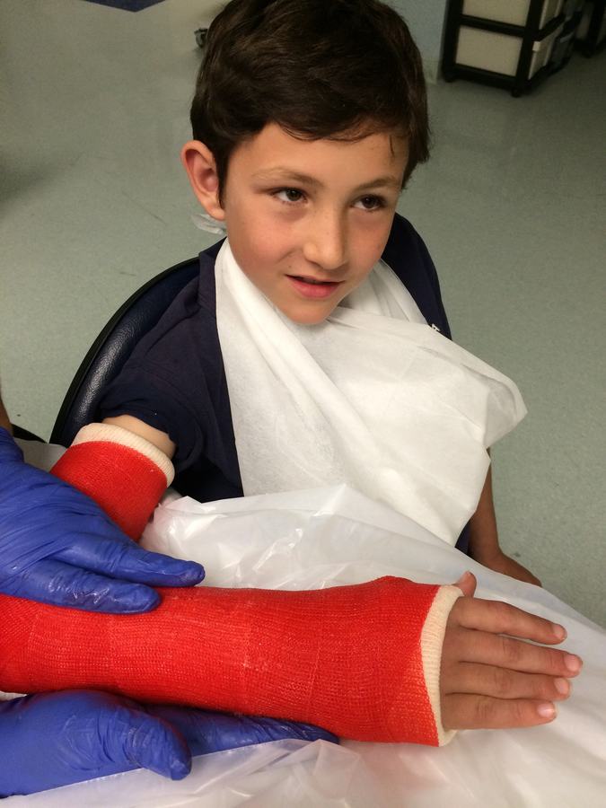 A red plaster cast being fitted on a boy's arm at the clinic