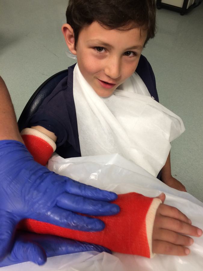 Boy showing off his red arm cast